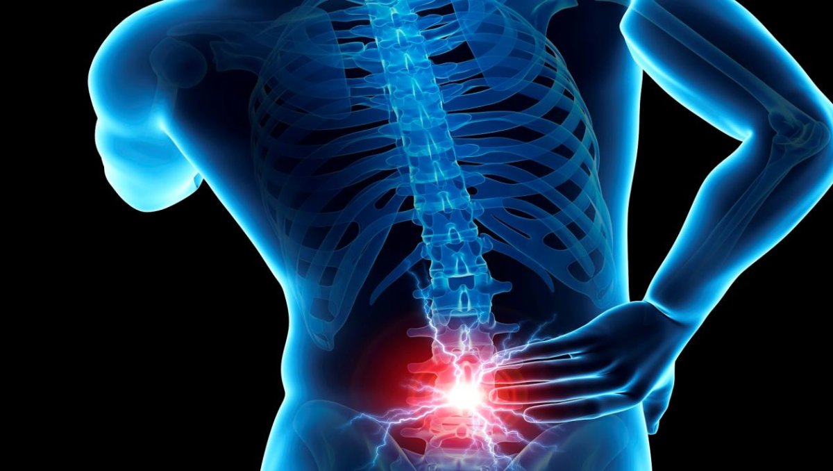 أفضل دكتور لعلاج الديسك في الإمارات