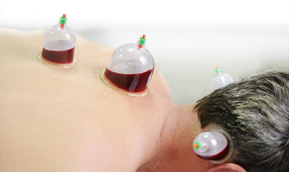 أفضل مركز حجامة في أبوطبي 2023