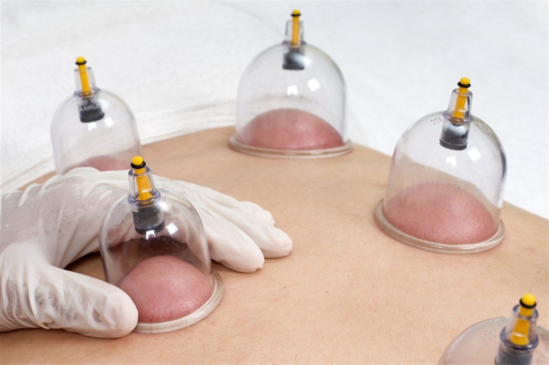 أهم وأبرز مراكز الحجامة في أبوظبي 2024