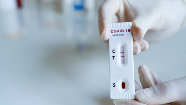 نبذة عن جهاز اختبار المستضد السريع لفيروس كورونا في دبي