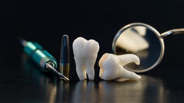 دليل أشهر عيادات الأسنان في العين لعام 2024